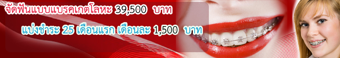 รากเทียม ราคาถูก